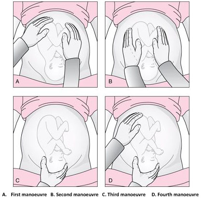 ultrasound presentation unstable