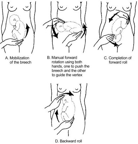 ultrasound presentation unstable