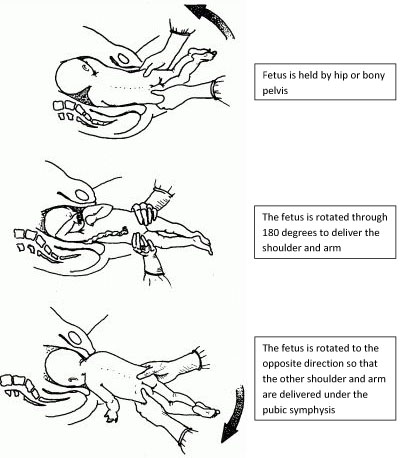 ultrasound presentation unstable