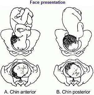 ultrasound presentation unstable