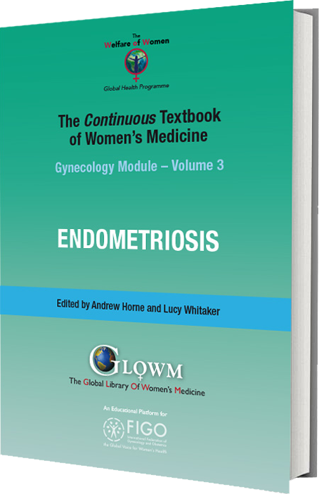 Endometriosis: Causes & Symptoms - SOG Health Pte. Ltd.