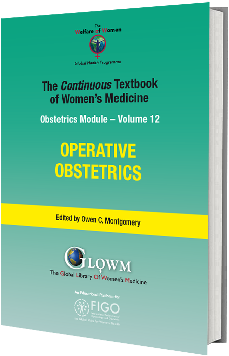 PDF] Uterine prolapse as an unusual cause of obstructed labor: A case  report